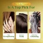 Richfeel Scalp Cleanser - 100ml